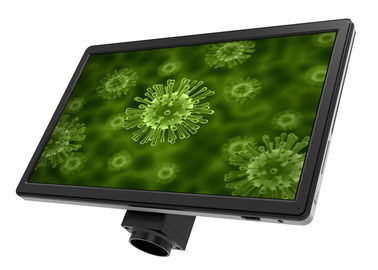 중국 가득 차있는 HD 16 MP 현미경 부속품 LCD 스크린 UOP XSP-16.0 검정 협력 업체