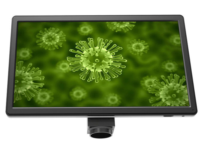 가득 차있는 HD 16 MP 현미경 부속품 LCD 스크린 UOP XSP-16.0 검정